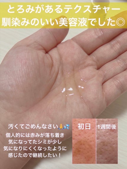 を使ったクチコミ(3枚目)