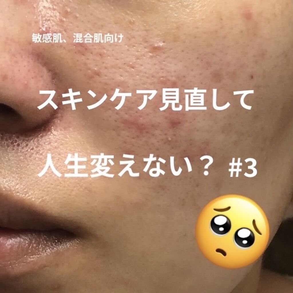 グリーンダーマCICA デイリーシートマスク/ネイチャーリパブリック/シートマスク・パックを使ったクチコミ（1枚目）