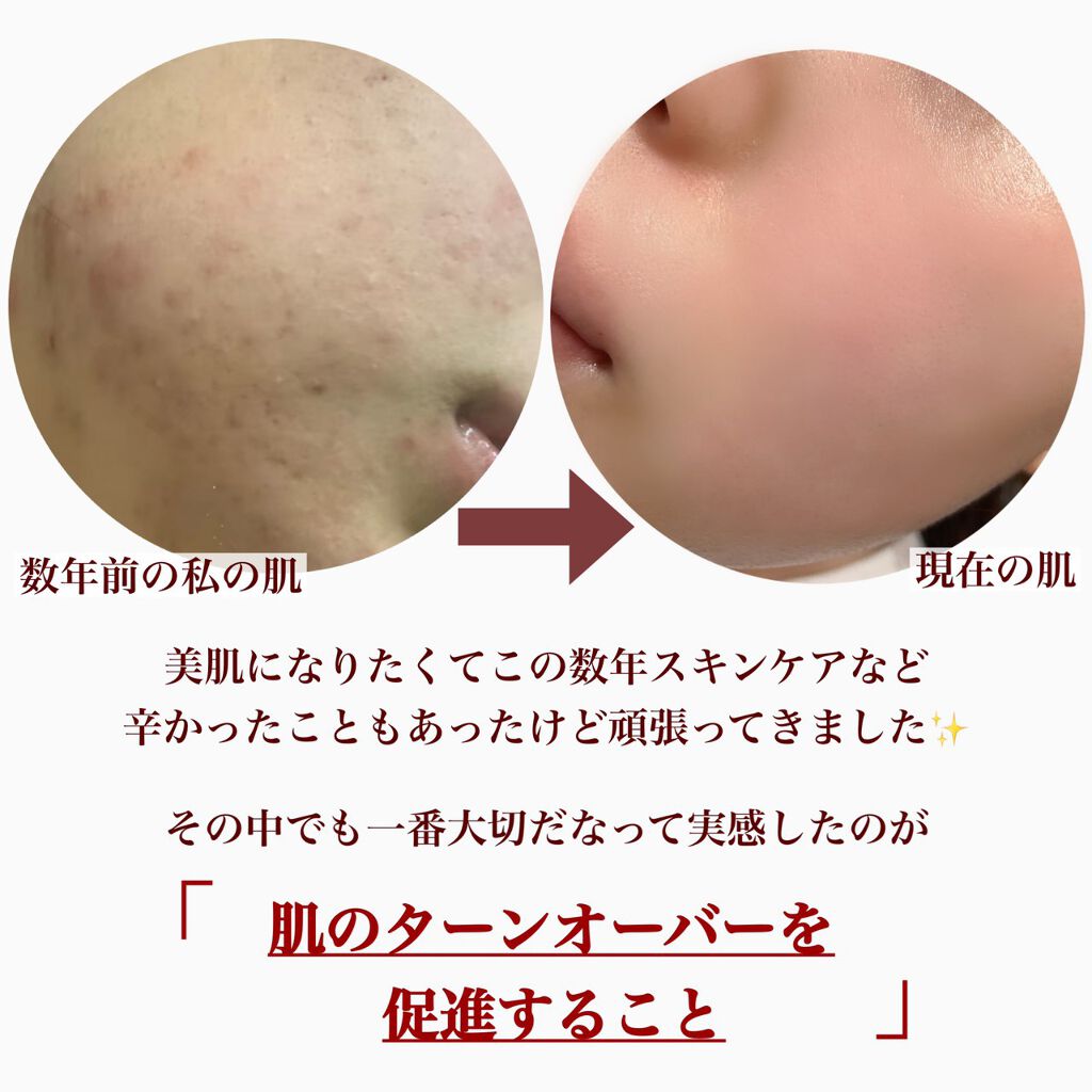 エクストラクトRSローション/エクスピュール/化粧水を使ったクチコミ（2枚目）