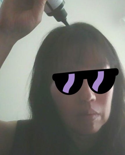 ナノグロウリッチ/iqumore/頭皮ローションを使ったクチコミ(2枚目)