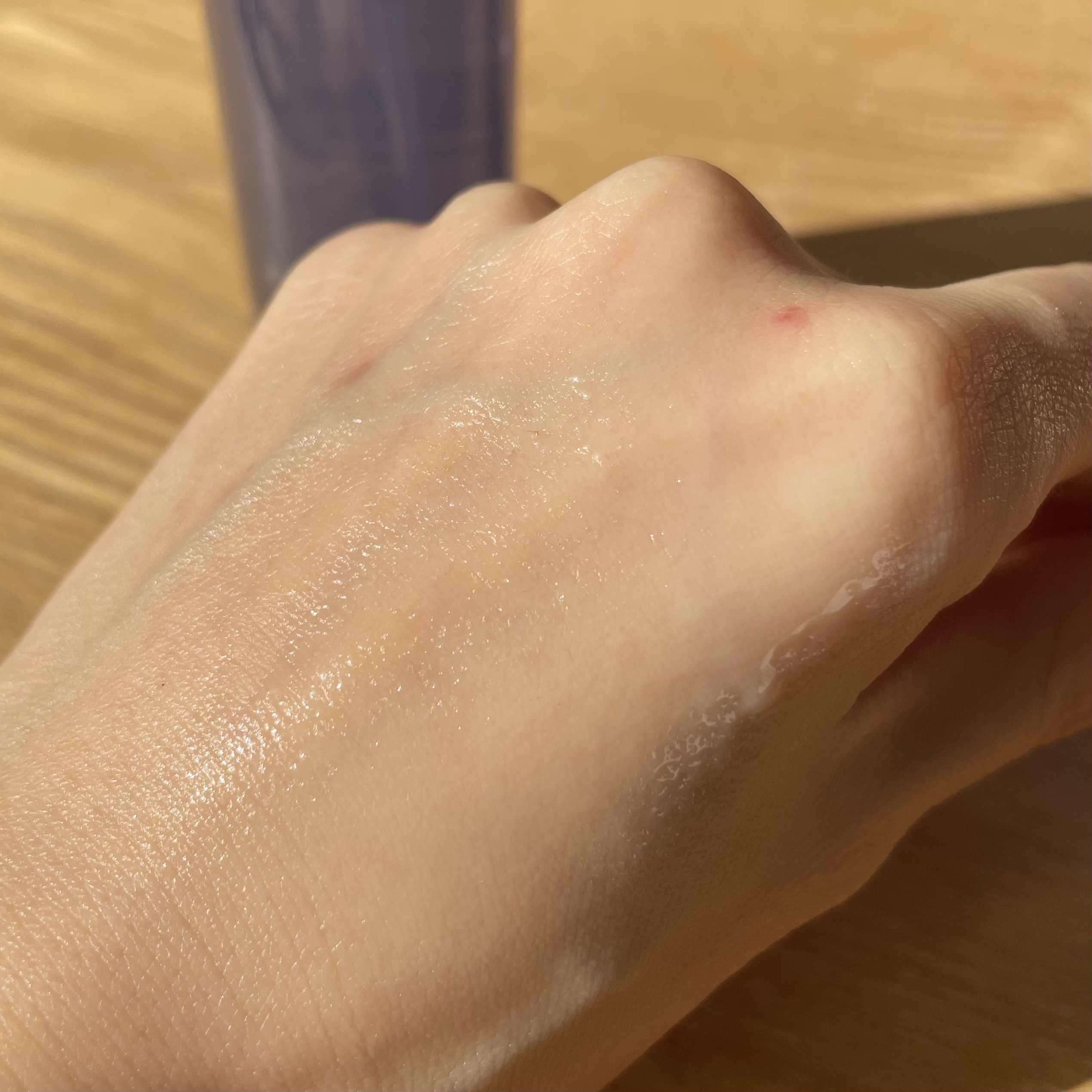 ブラックスネイル クリーム/Dr.G/フェイスクリームを使ったクチコミ（3枚目）