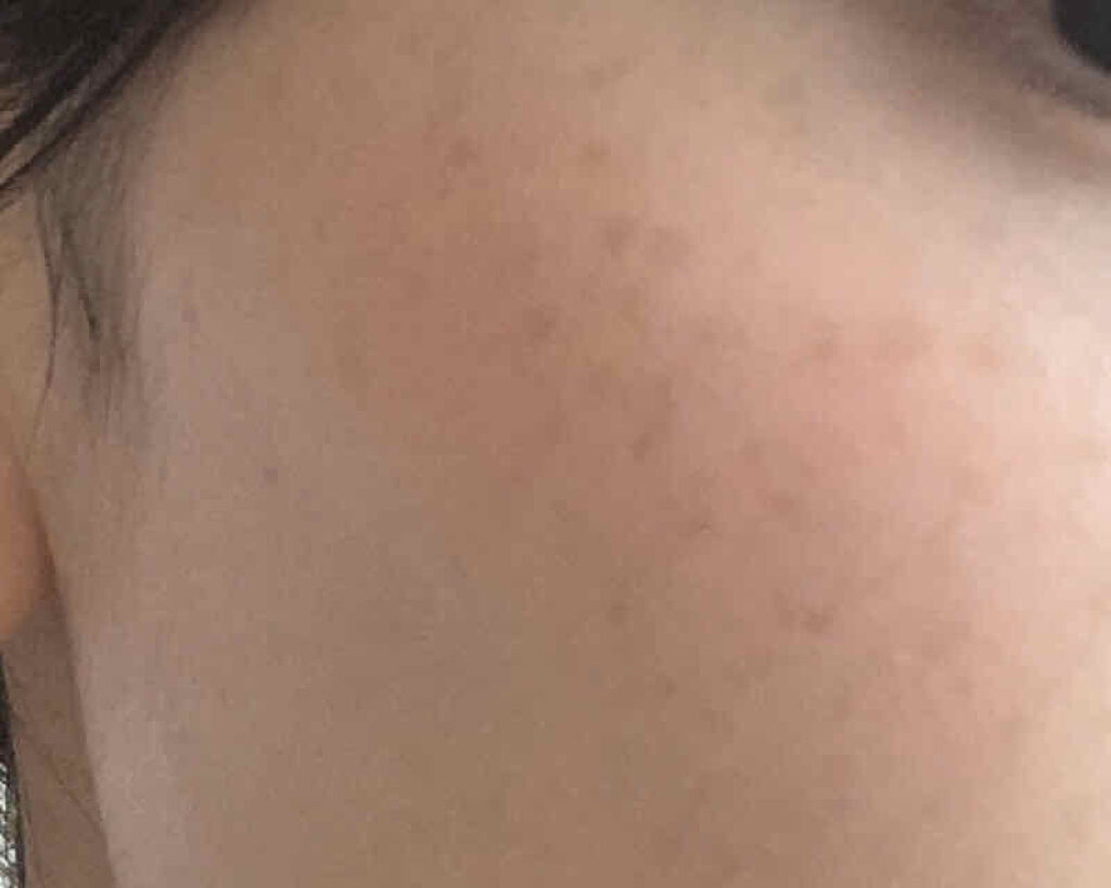 チークポリッシュ/ADDICTION/リキッドチークを使ったクチコミ（3枚目）