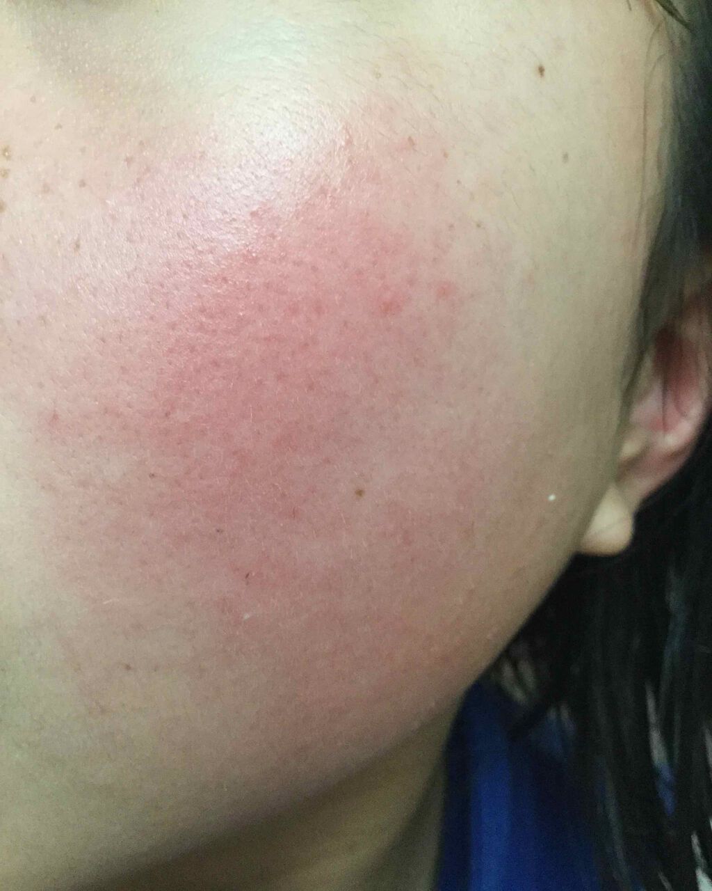 クリアターン ベイビッシュ ホワイトマスク/クリアターン/シートマスク・パックを使ったクチコミ(1枚目)