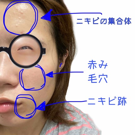 薬用しみ対策 美白化粧水/メラノCC/化粧水を使ったクチコミ(3枚目)