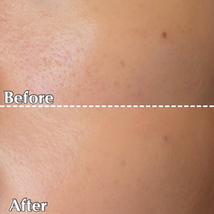 メルティフィットコンシーラー/インテグレート/パレットコンシーラーを使ったクチコミ(7枚目)