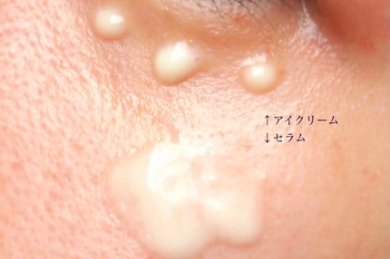 レチノールインテンシブ アドバンスドトリプルアクションアイクリーム/SOME BY MI/アイケア・アイクリームを使ったクチコミ(5枚目)