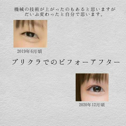 アイトーク/アイトーク/二重まぶた用アイテムを使ったクチコミ(2枚目)