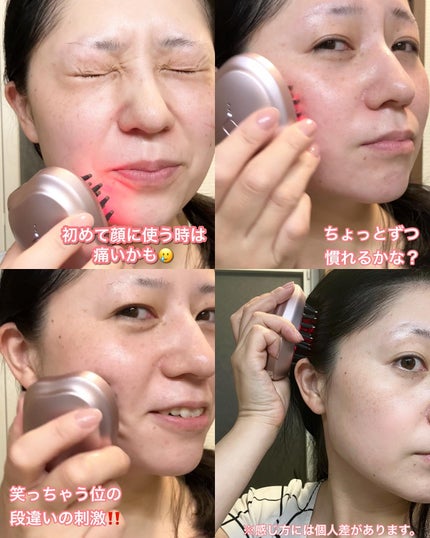 デンキブラシ モッサーモ/CBS cosmetics/ヘッドマッサージャーを使ったクチコミ(6枚目)