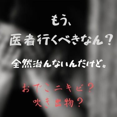 こんにちは！るっちーです。🥺
2枚！⚠ごめんなさい🙇炎上じゃなくて、炎症でした🙇

なおらん。。。炎症してヒリヒリしてたのと、赤みはなくなったものの、
プツプツが消えない😭😭😭😭😭😭.なんでだてえ。。。