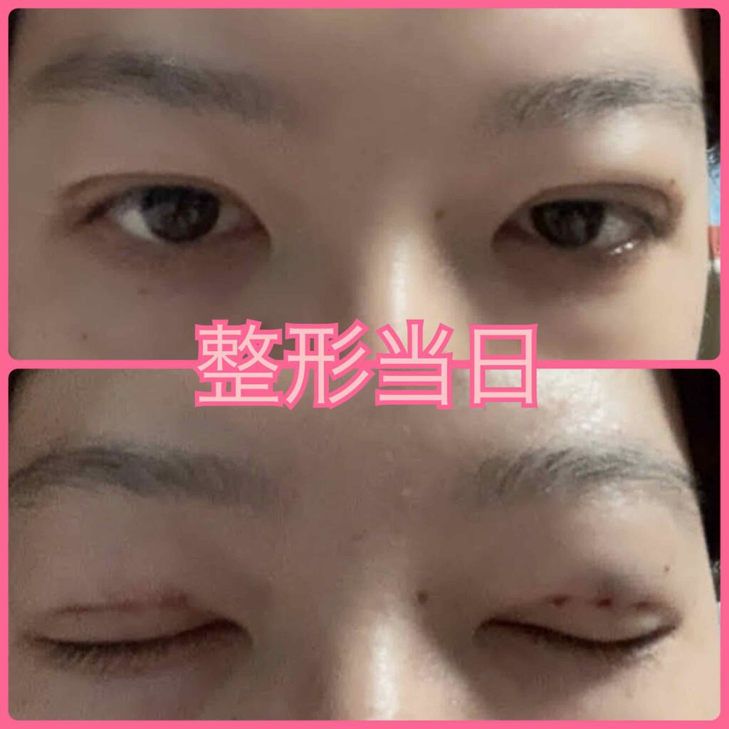 ê§ð¬¹â³ðŸððŸðð¶ð¬¹ê§ on LIPS ãâ ïžæŽåœ¢åŸã®åçãèŒããã®ã§ãèŠæãªæ¹ã¯æ³šæããŠãã ãã6æã«..ãïŒ1æç®ïŒ