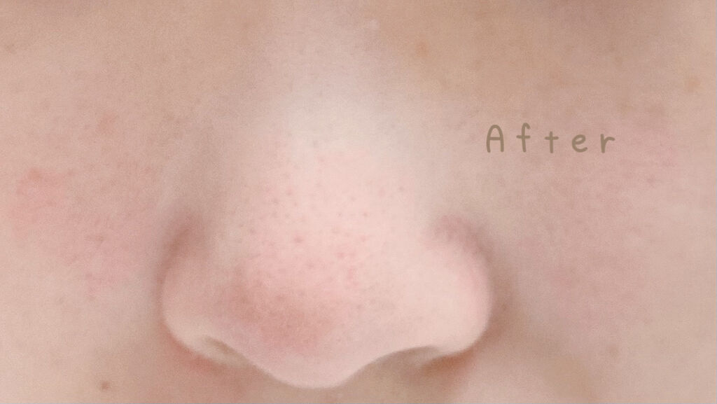 BLACK O2 泡パック charcoal /PUREDERM/シートマスク・パックを使ったクチコミ（3枚目）