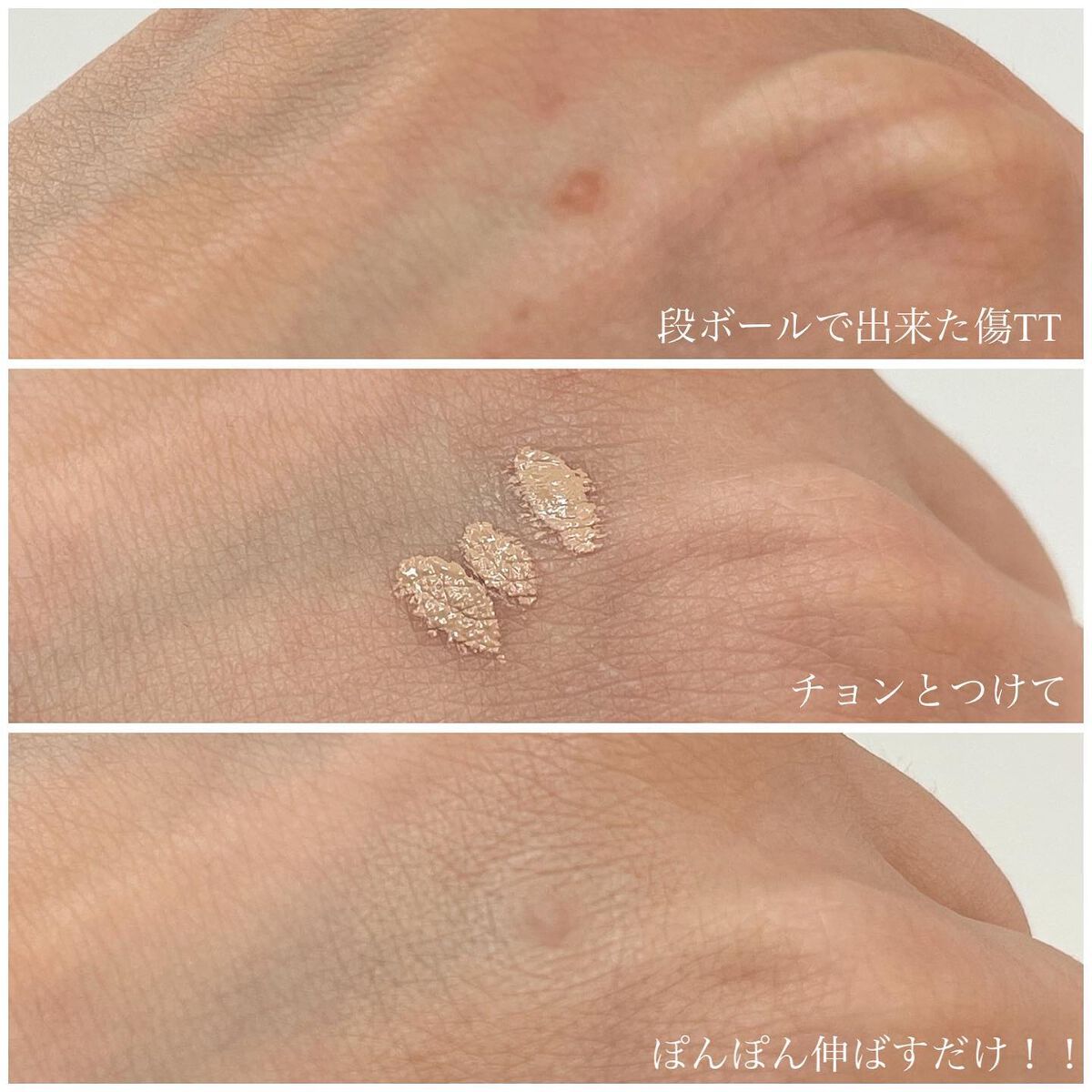 GGマルチコンシーラー/gesgep/リキッドコンシーラーを使ったクチコミ(2枚目)