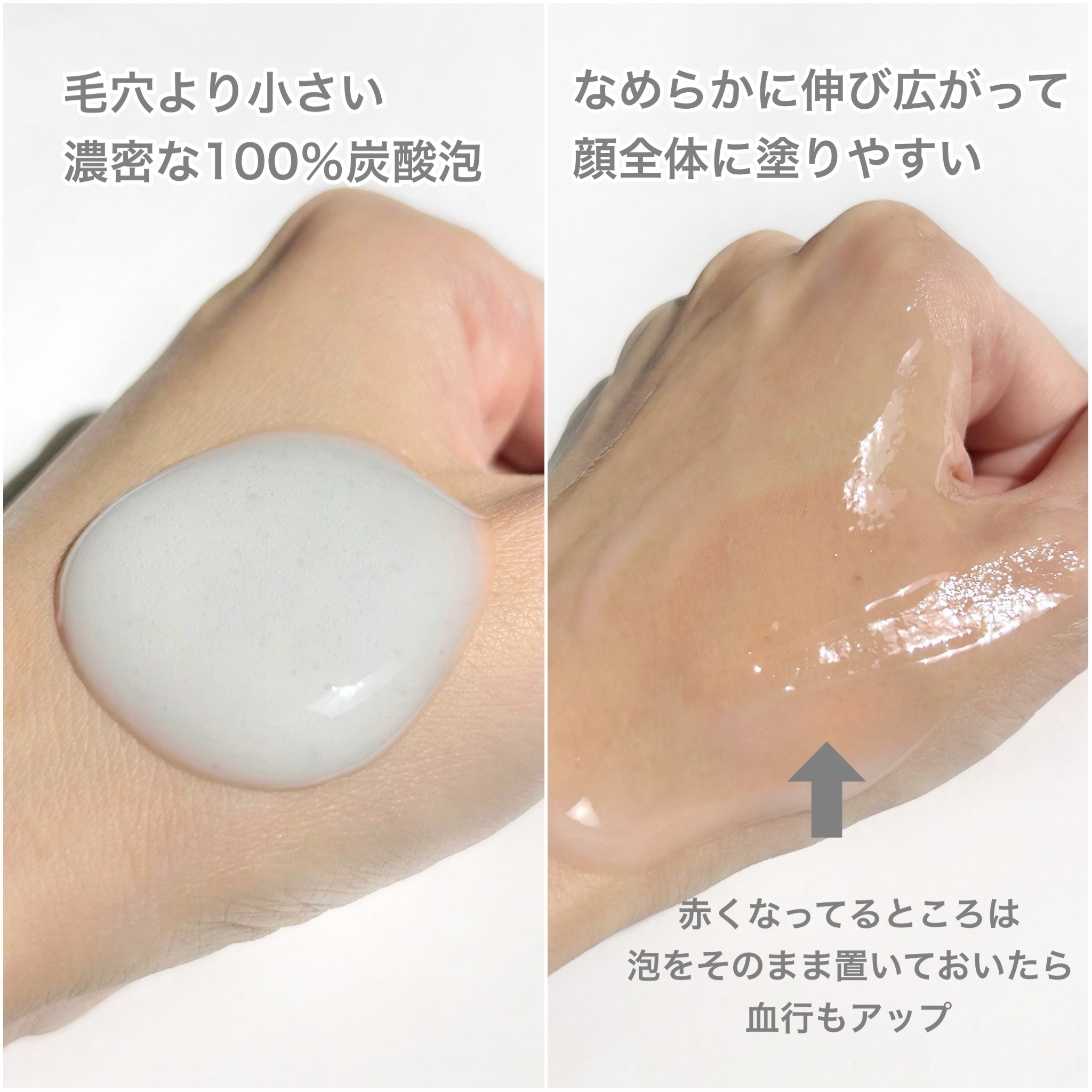 ソフィーナ iP 薬用シワ改善 泡セラム/SOFINA iP/美容液を使ったクチコミ（3枚目）