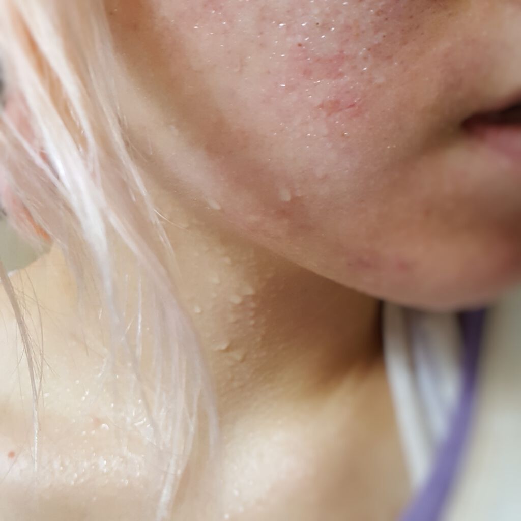 ハッカツ/スリムトビラ/健康サプリメントを使ったクチコミ(4枚目)