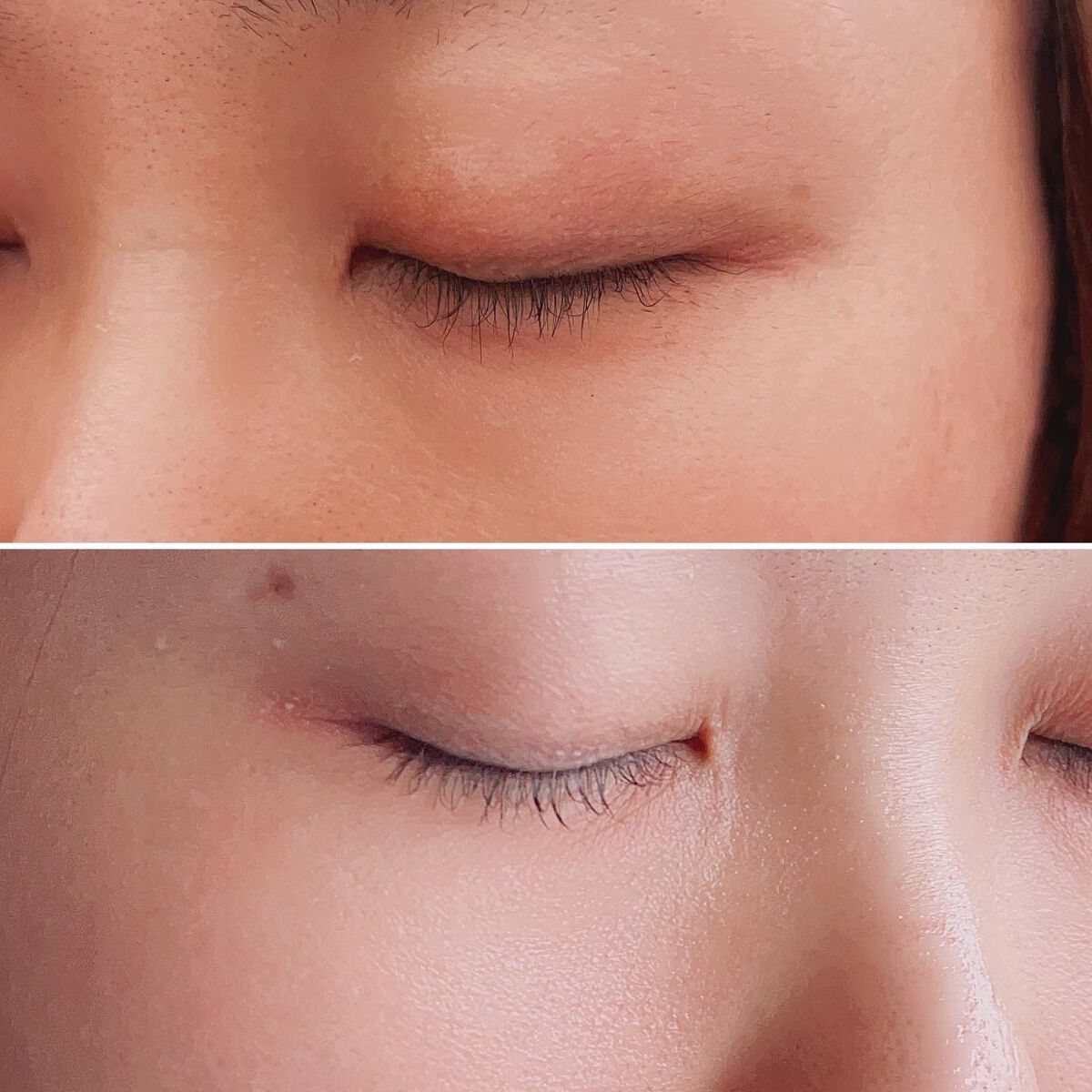 yumi♡フォロバ on LIPS 「美容のプロ滝川が企画、
セルソース
再生医療センターが
開発し..」(4枚目)