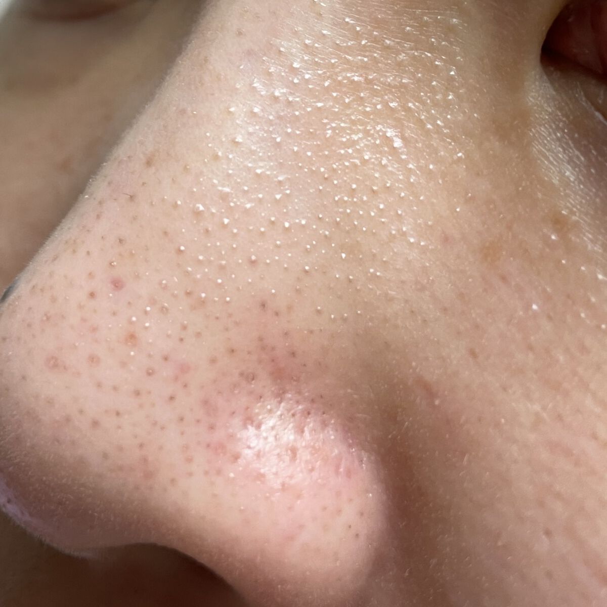 毛穴小町マスク		/クリアターン/シートマスク・パックを使ったクチコミ（2枚目）