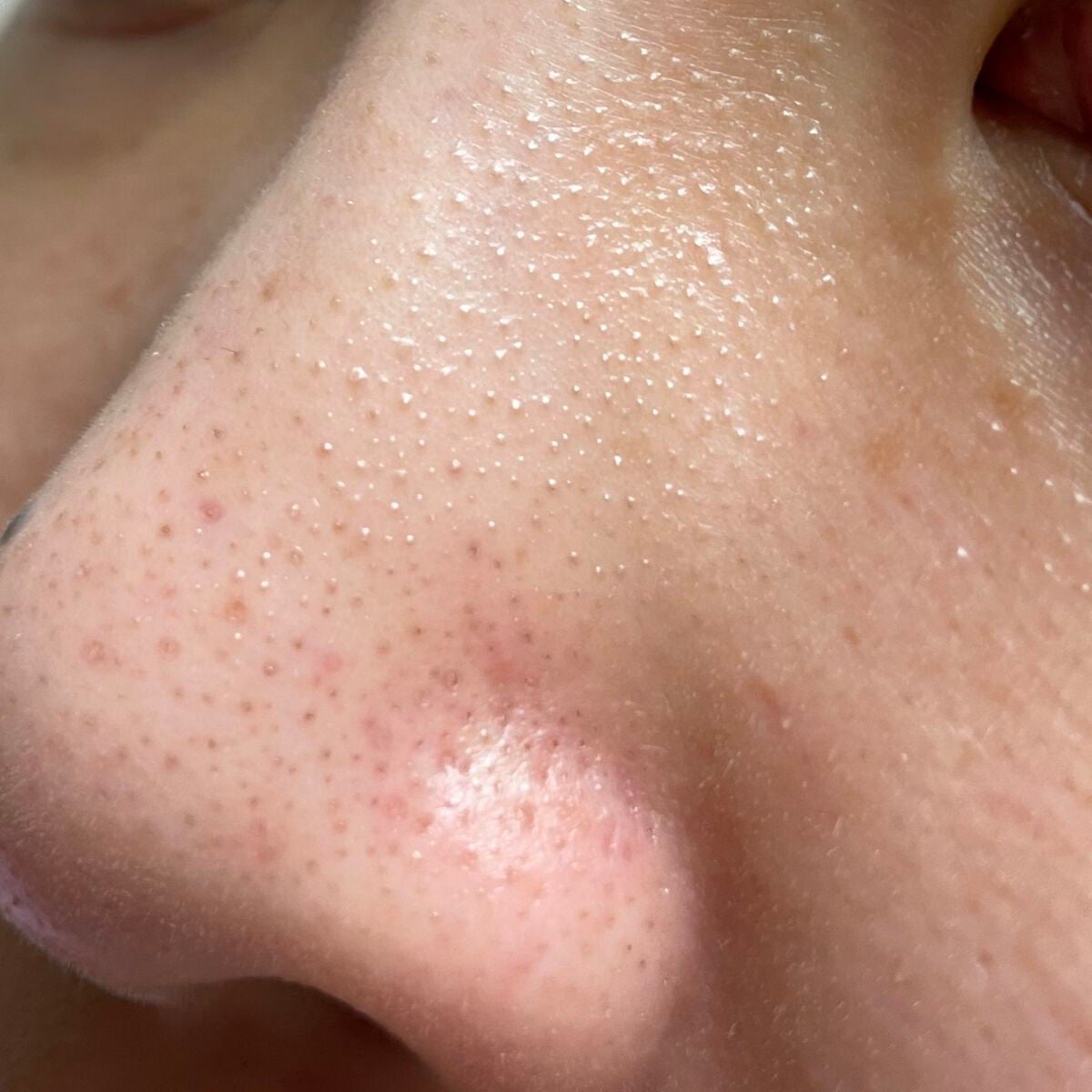 ごめんね素肌マスク/クリアターン/シートマスク・パックを使ったクチコミ(2枚目)