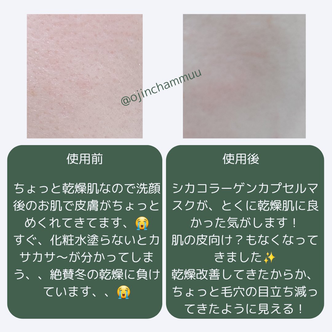 シカコラーゲン カプセルマスク/VT/洗い流すパック・マスクを使ったクチコミ（2枚目）