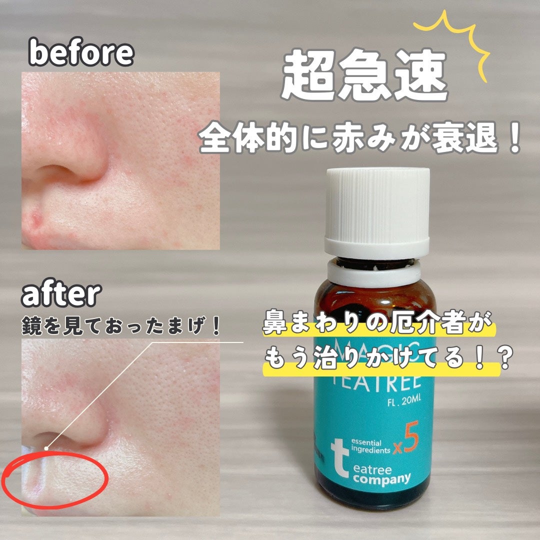 マジックティーツリーオイル/ブラン/フェイスオイルを使ったクチコミ(2枚目)