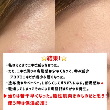 AZアゼライン酸10セラム/コスデバハ/美容液を使ったクチコミ(5枚目)