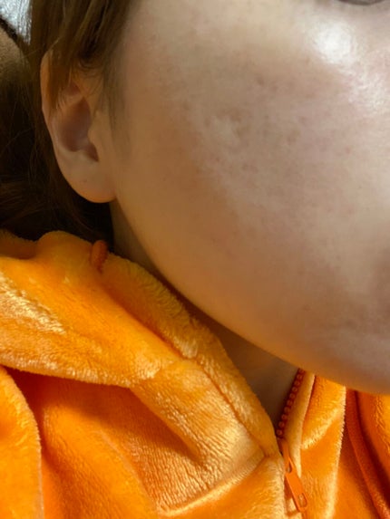 ビジャ ローション/innisfree/乳液を使ったクチコミ(2枚目)