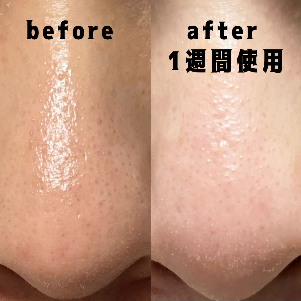 ワンデイズユー ディープクレンジグオイル/One-day's you/オイルクレンジングを使ったクチコミ（3枚目）