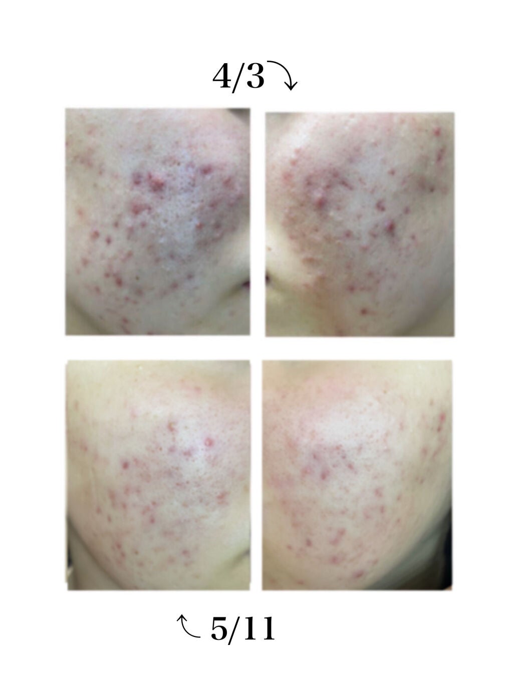 薬用 しみ 集中対策 美容液/メラノCC/美容液を使ったクチコミ(3枚目)