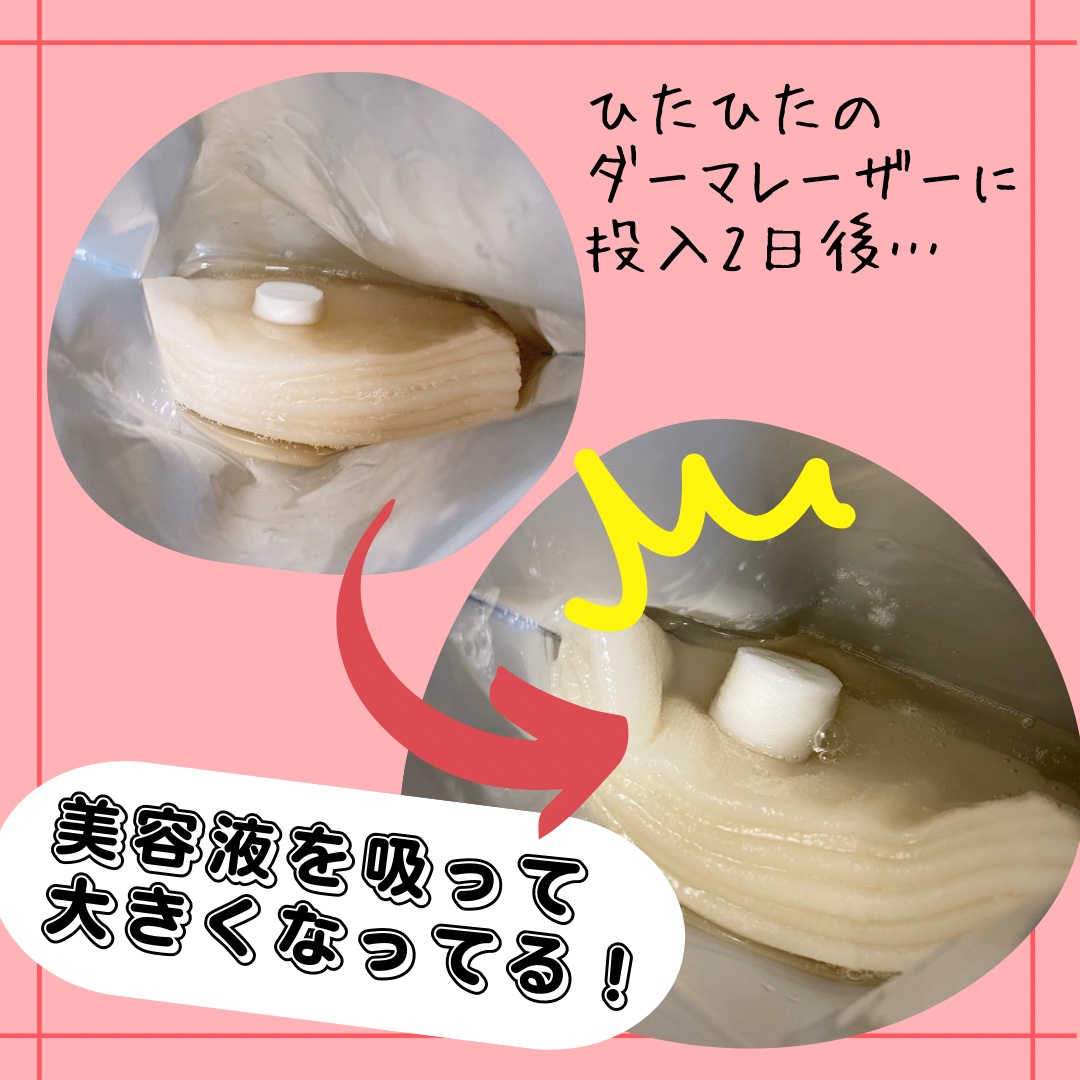 圧縮フェイスマスク/DAISO/シートマスク・パックを使ったクチコミ（2枚目）