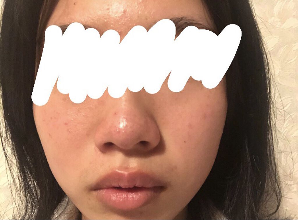 艶肌ドロップ/ラッシュ/美容液を使ったクチコミ（3枚目）