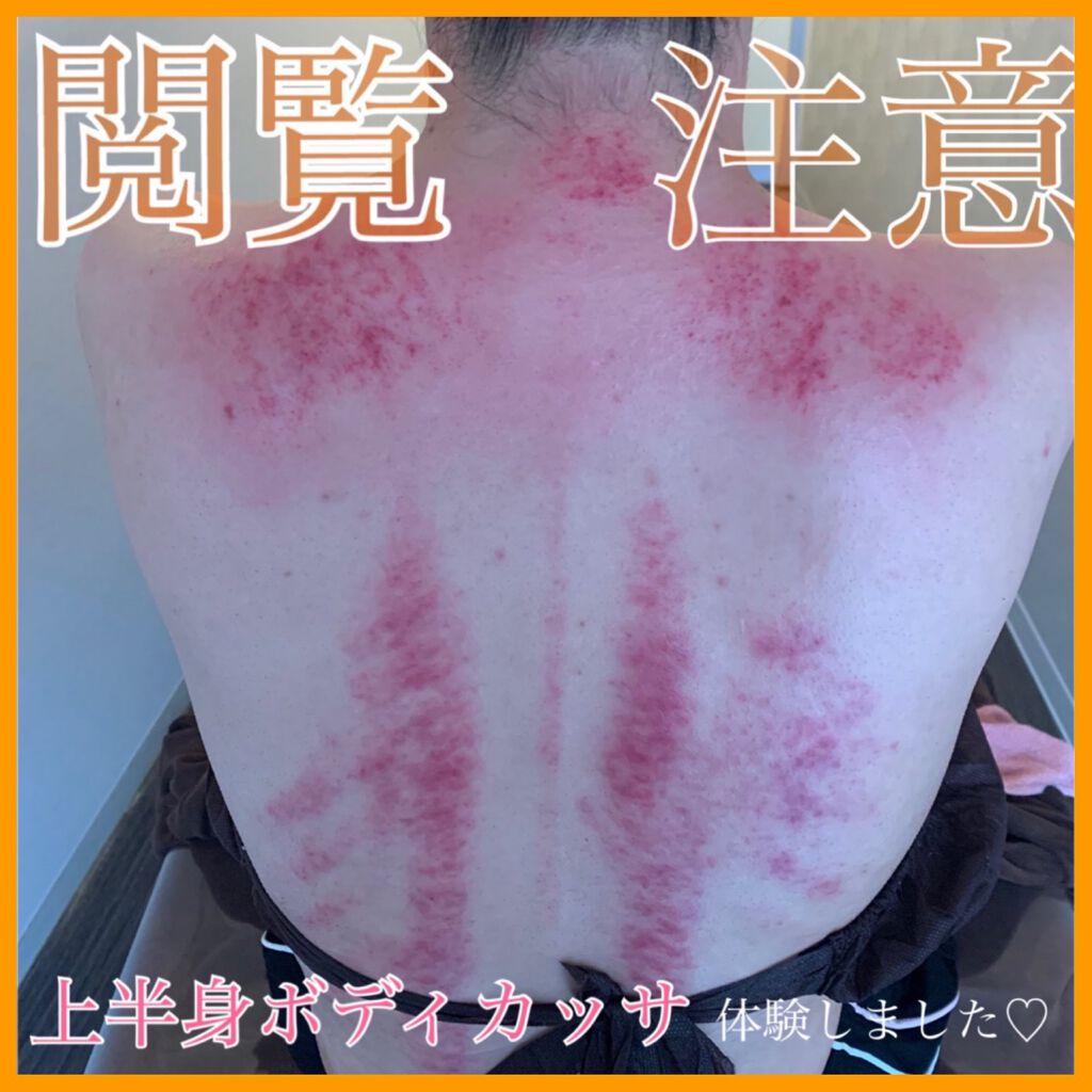 を使ったクチコミ（1枚目）