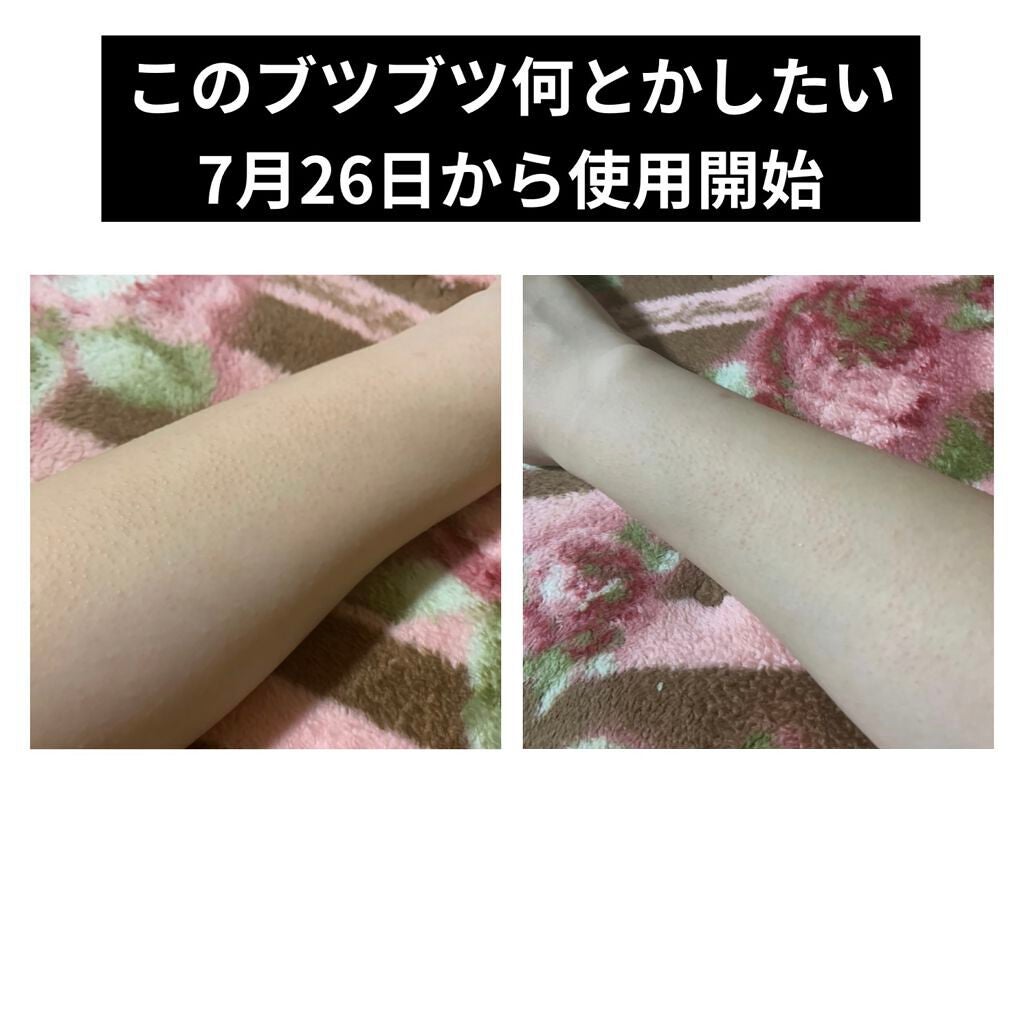 ニノキュア(医薬品)/ニノキュア/その他を使ったクチコミ(1枚目)