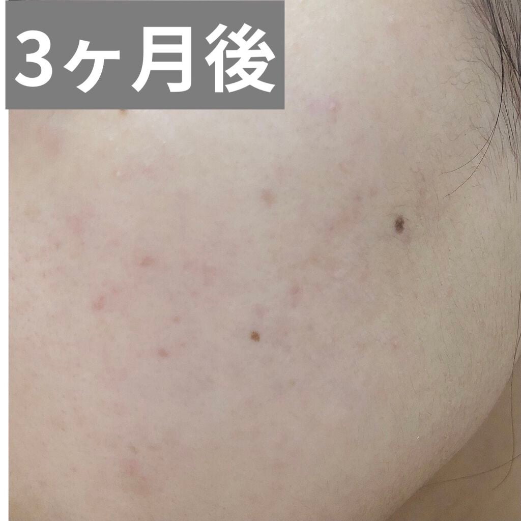パウダーウォッシュプラス/オルビス/洗顔パウダーを使ったクチコミ(4枚目)