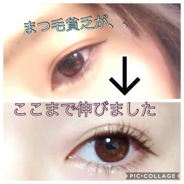 スカルプD まつ毛美容液♡
お目汚し失礼しますっ⚠️

元々 まつ毛短い☁️ 
ビューラーした直後下がる☁️
下地塗ろうが キープ力ゼロ☁️
の私でした、、、

まつ毛美容液いくつか購入し、試しましたが