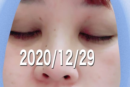 EMAKED(エマーキット)/水橋保寿堂製薬/まつげ美容液を使ったクチコミ(2枚目)