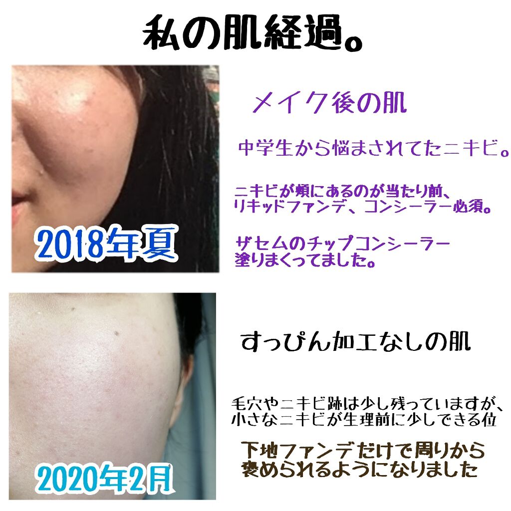 ティーツリーケアソリューション アンプルマスクJEX/MEDIHEAL/シートマスク・パックを使ったクチコミ(1枚目)