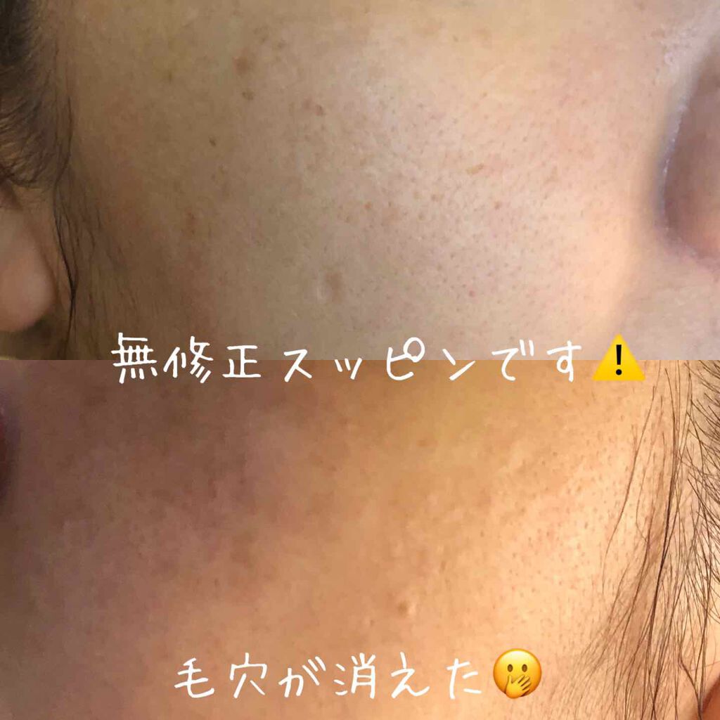 アクアリングヌードゲルマスク/MEDIHEAL/シートマスク・パックを使ったクチコミ（3枚目）