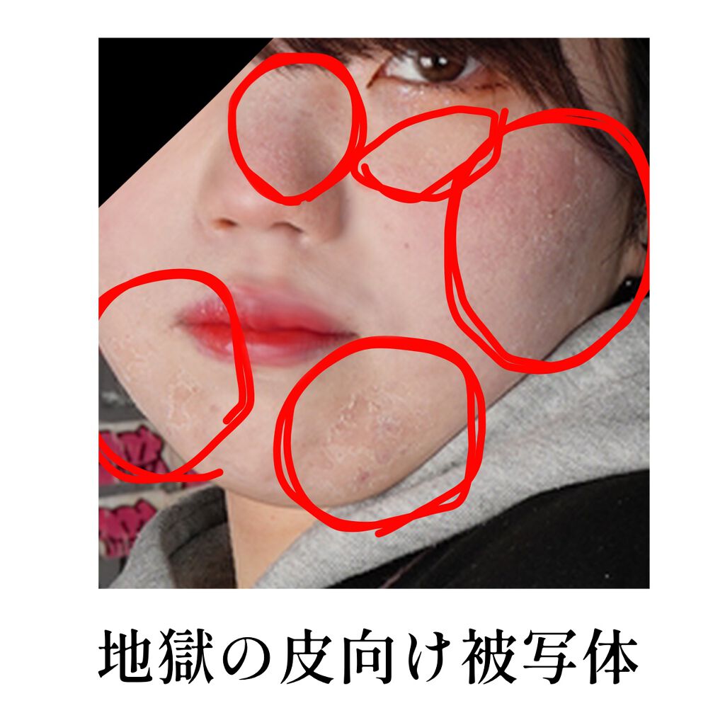 ティーツリーケア ソリューション エッセンシャルマスクEX/MEDIHEAL/シートマスク・パックを使ったクチコミ(3枚目)