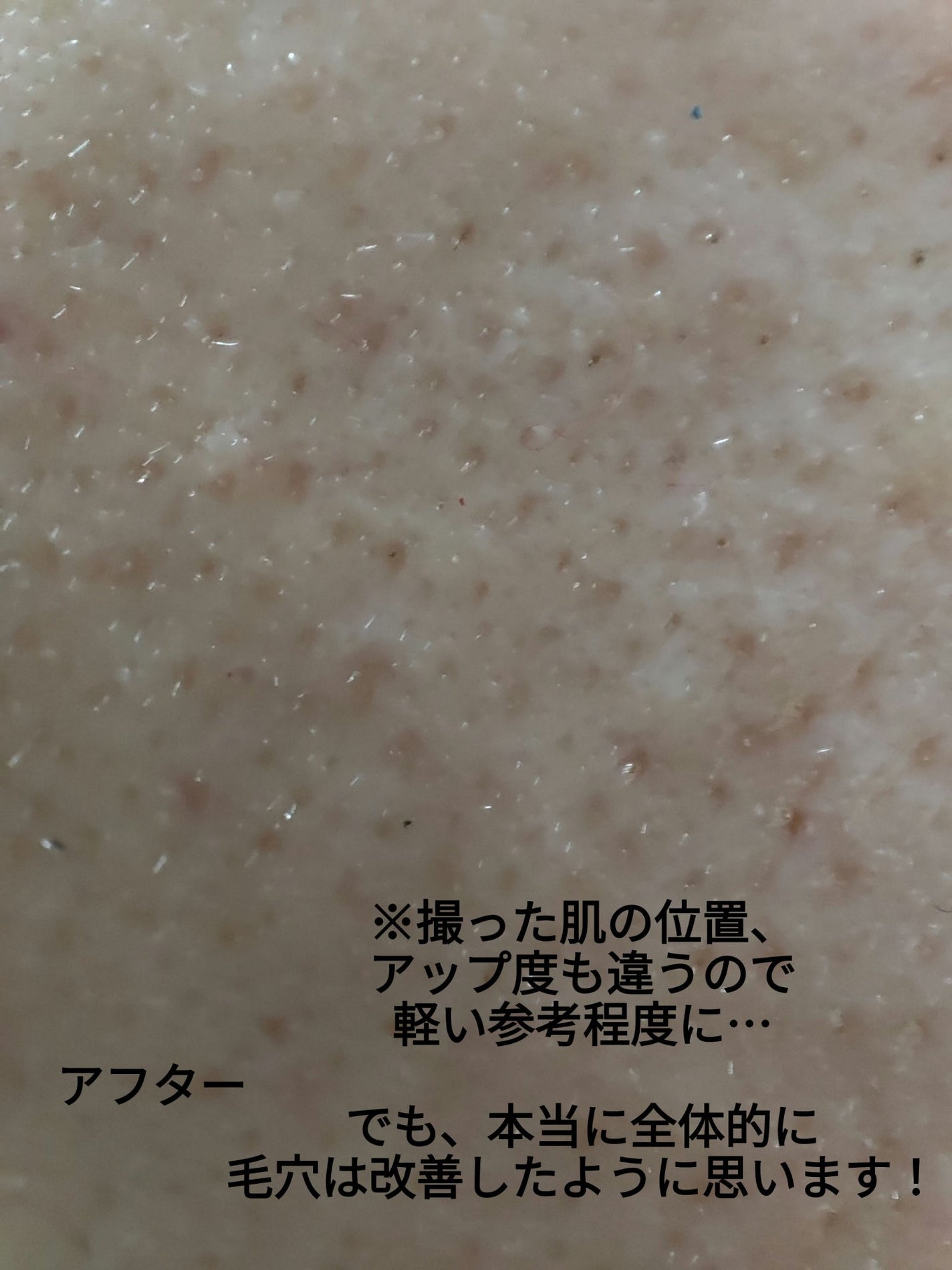 レチビタエッセンスマスク/ピュレア/シートマスク・パックを使ったクチコミ(5枚目)