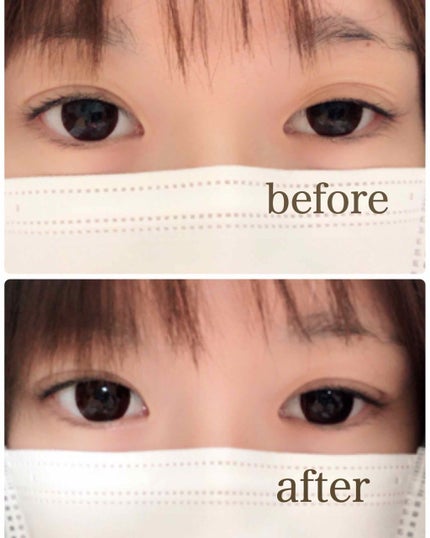 アイテープ(絆創膏タイプ、レギュラー、70枚)/DAISO/二重まぶた用アイテムを使ったクチコミ(2枚目)