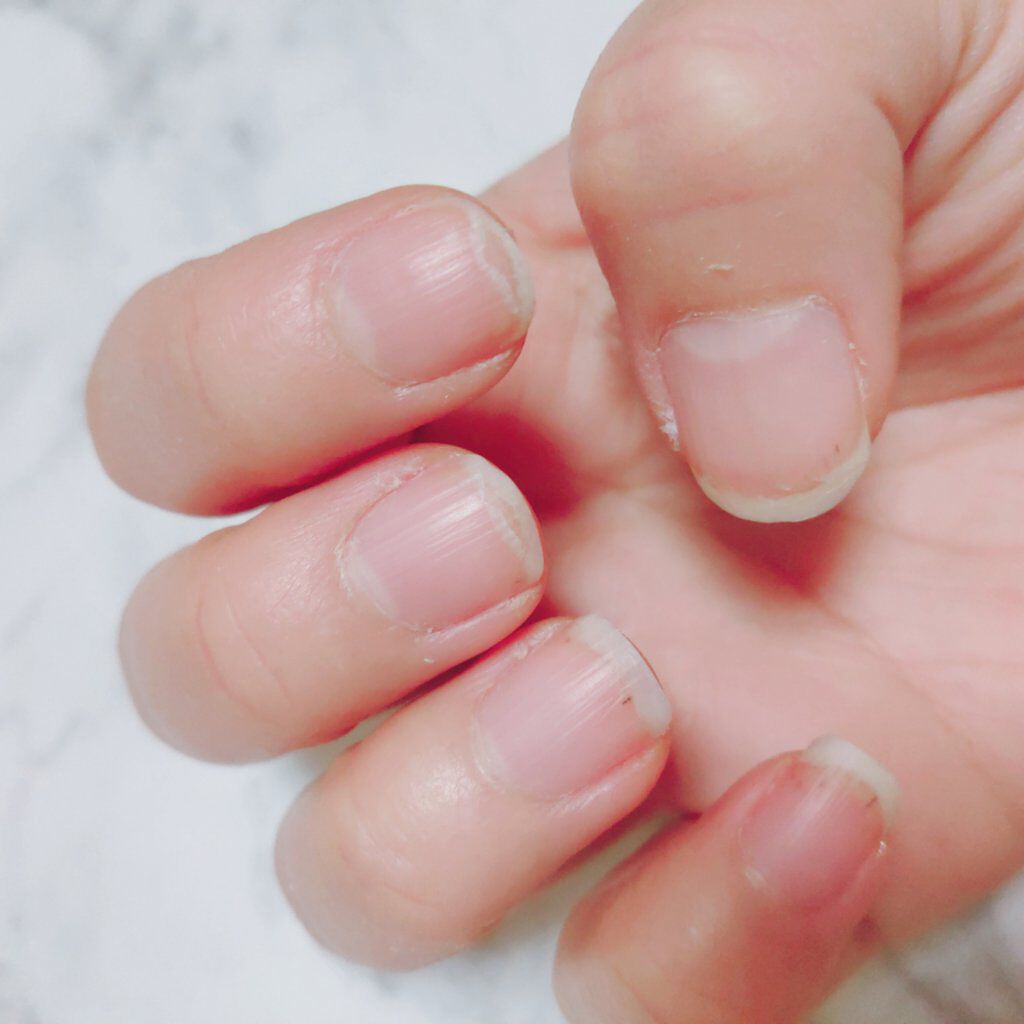 エルファー ネイルキッスB/DAISO/除光液を使ったクチコミ(3枚目)