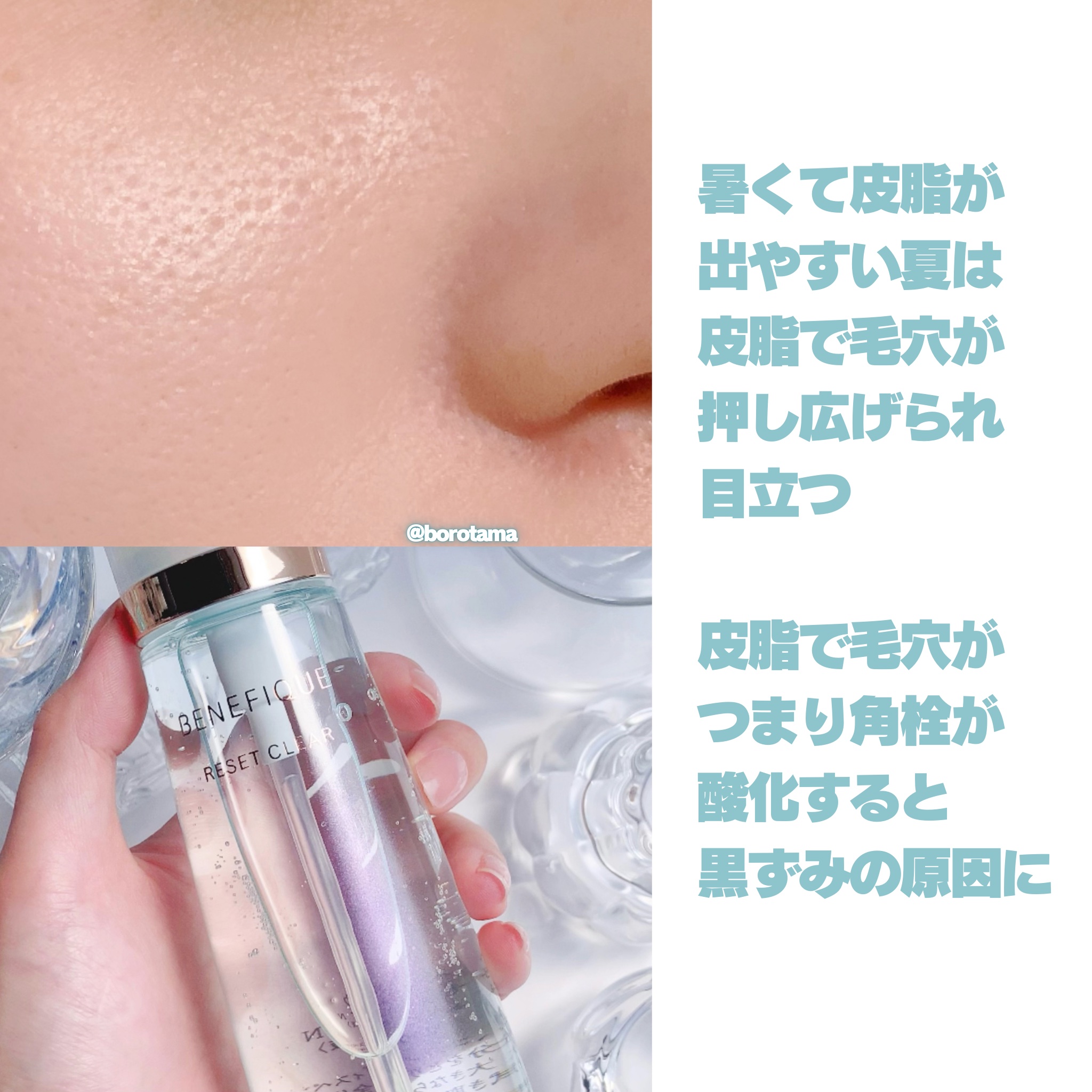 リセットクリアN/BENEFIQUE/化粧水を使ったクチコミ（3枚目）