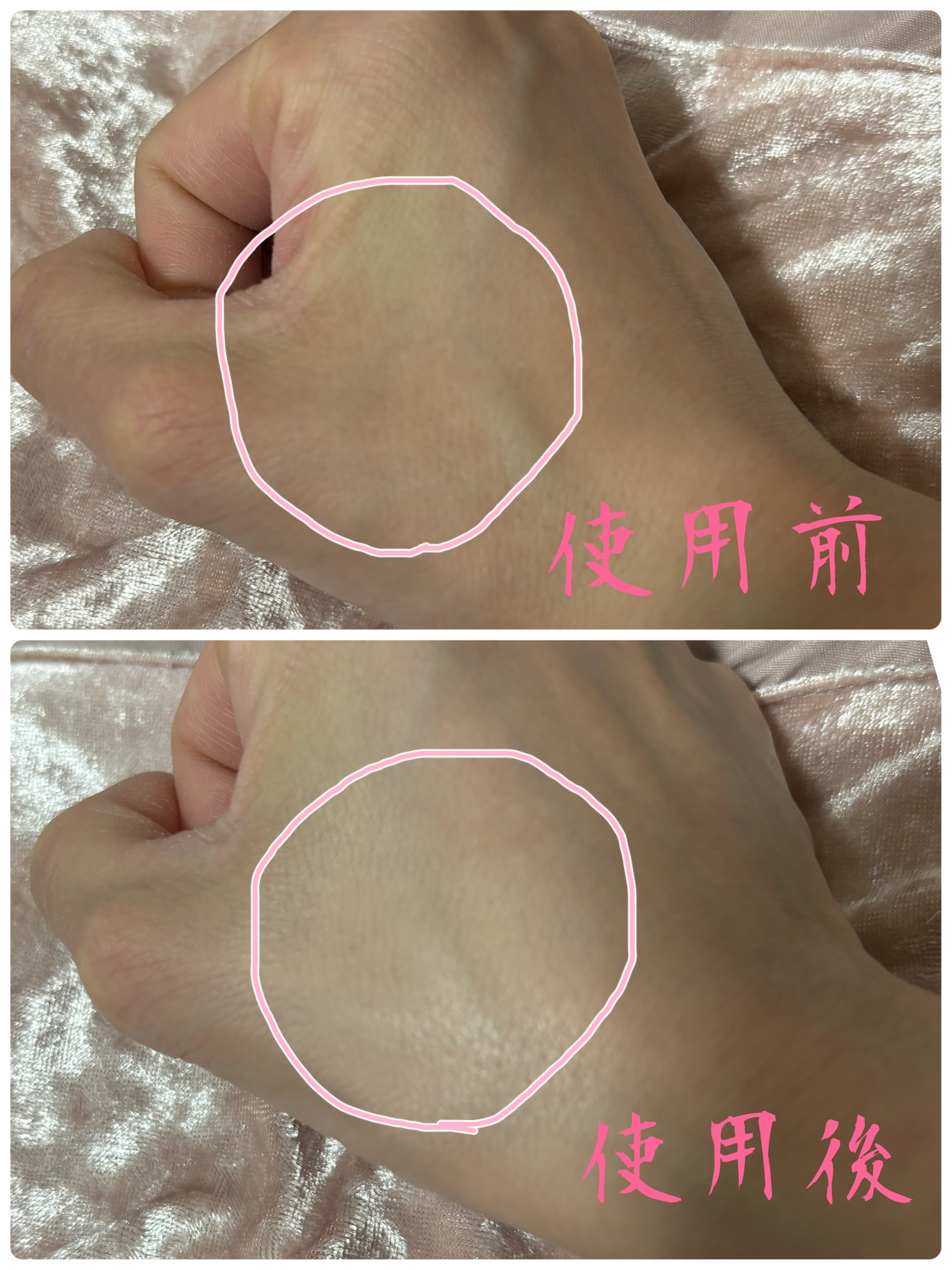 アンクル ド ポー ルクッションN/YVES SAINT LAURENT BEAUTE/クッションファンデーションを使ったクチコミ（3枚目）