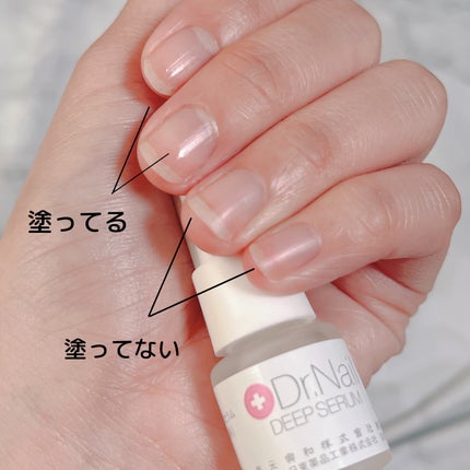 ディープセラム/Dr.Nail/ネイルオイル・トリートメントを使ったクチコミ(4枚目)