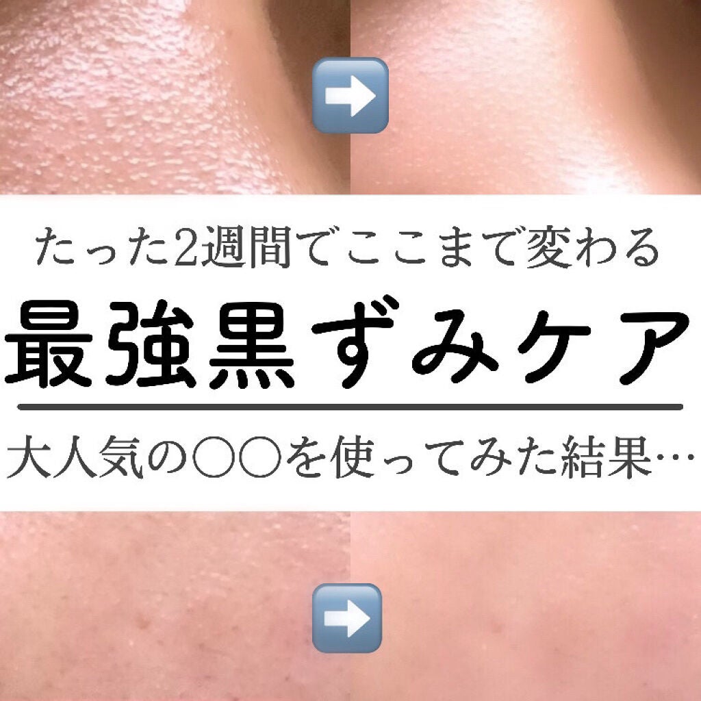 デュオ ザ クレンジングバーム ブラック/DUO/クレンジングバームを使ったクチコミ(1枚目)