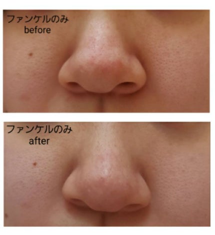 エマルジョンリムーバー 300ml/200ml/水橋保寿堂製薬/その他洗顔料を使ったクチコミ(4枚目)