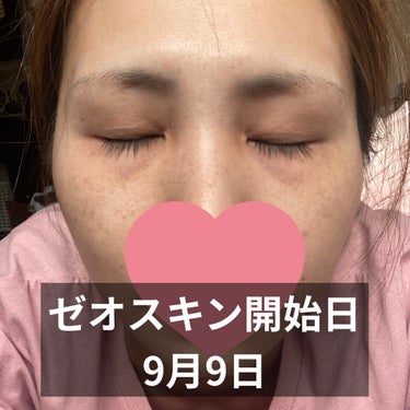 試してみた】BSサンスクリーンSPF50/ZO Skin Health | LIPS