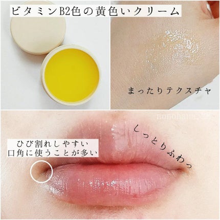 ユースキン メディカルリップクリーム  (医薬品)/ユースキン/その他を使ったクチコミ(2枚目)