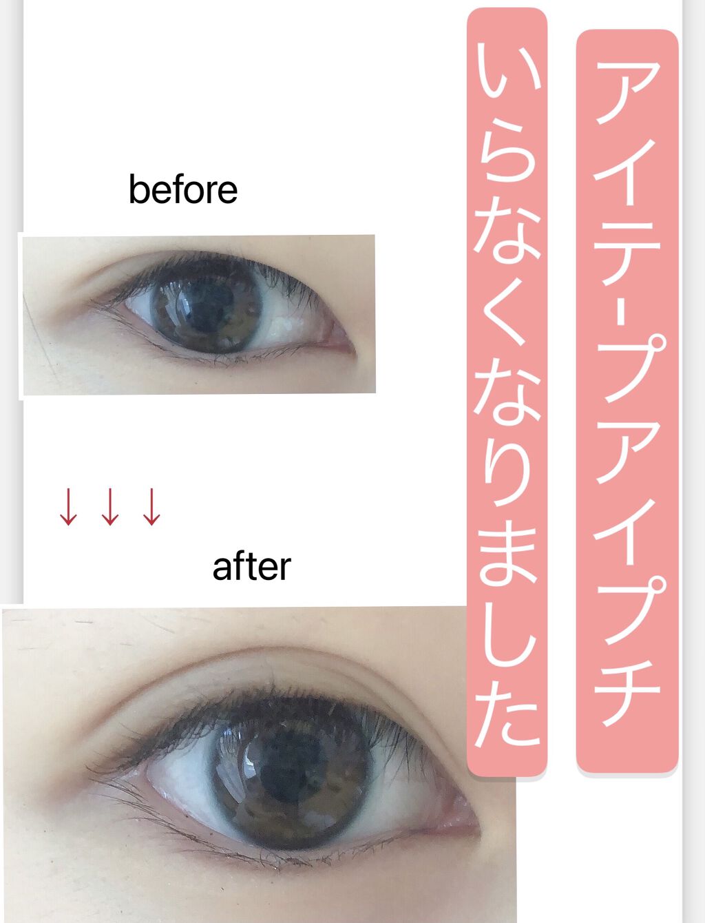 のびーるアイテープ（絆創膏タイプ、レギュラー）/DAISO/二重まぶた用アイテムを使ったクチコミ（1枚目）