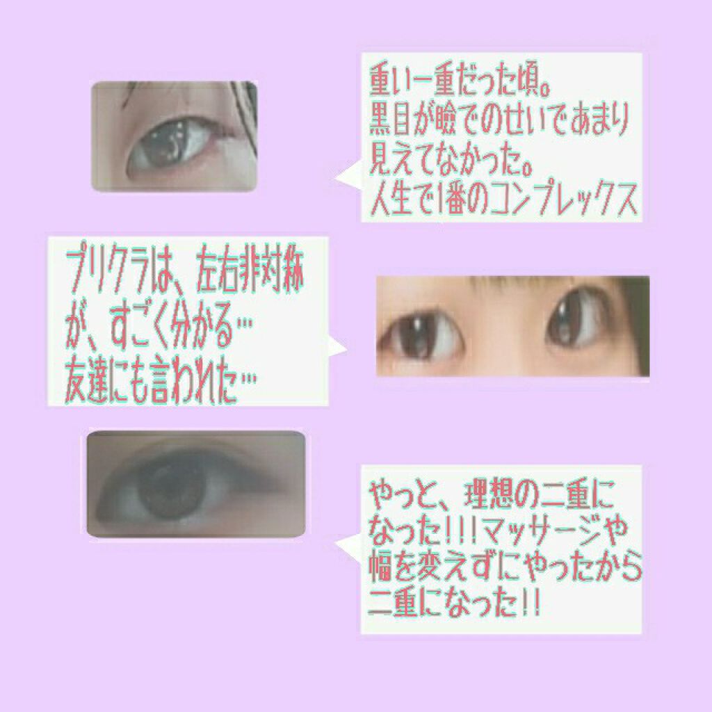 のびーるアイテープ（絆創膏タイプ、レギュラー）/DAISO/二重まぶた用アイテムを使ったクチコミ（2枚目）