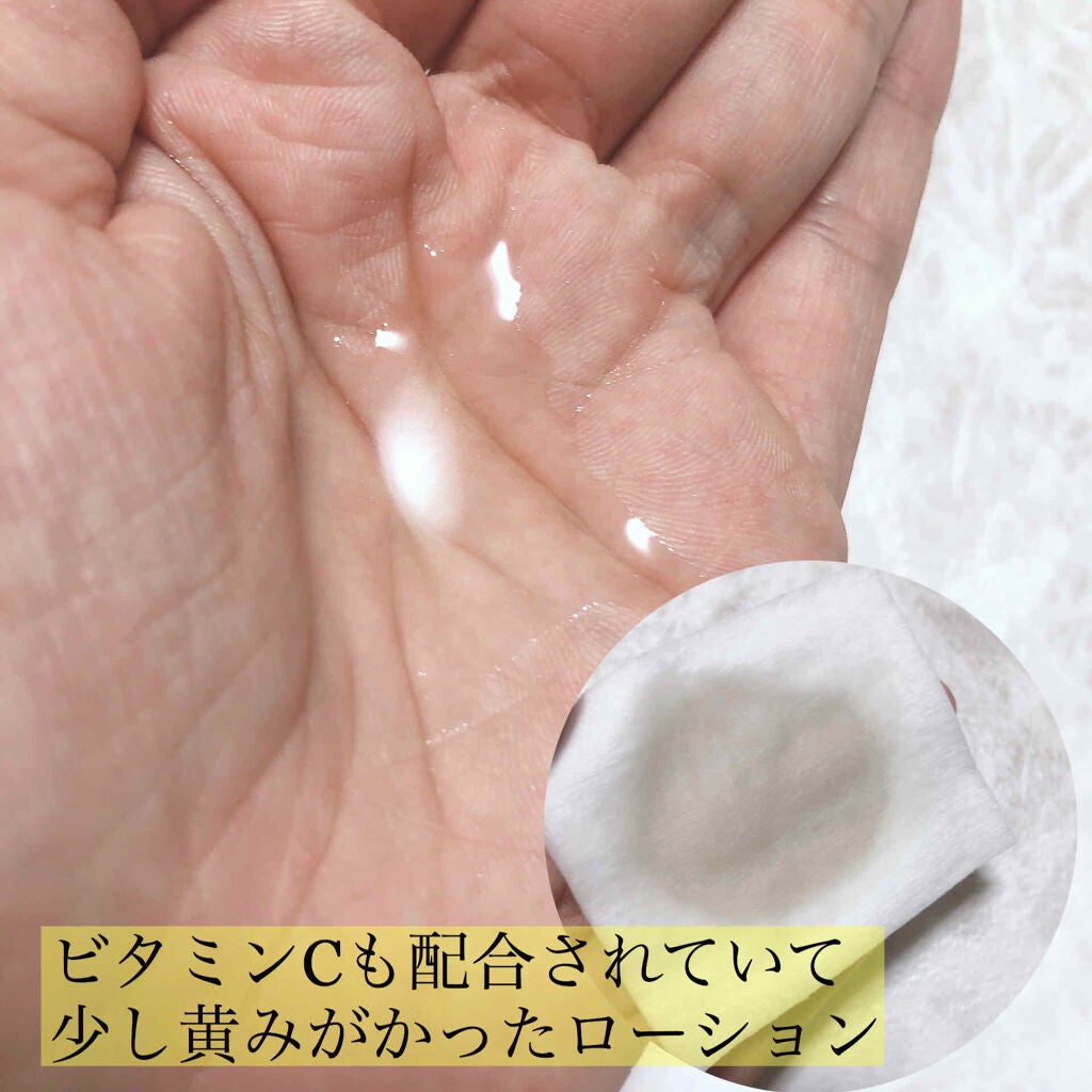 スキンフェイドローションV/デルミサ/化粧水を使ったクチコミ(2枚目)